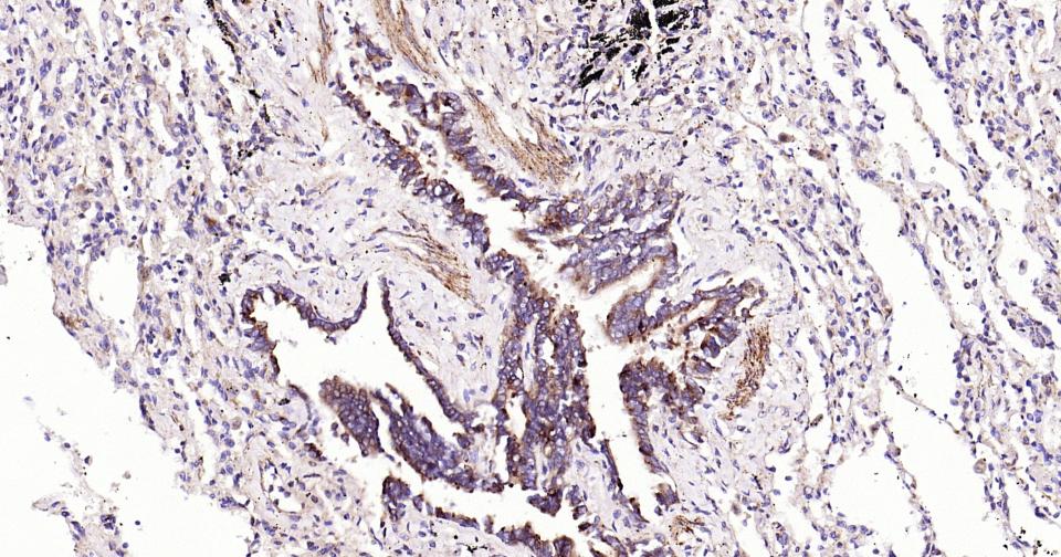 磷脂酰肌醇激酶3催化亚单位3重组兔单抗