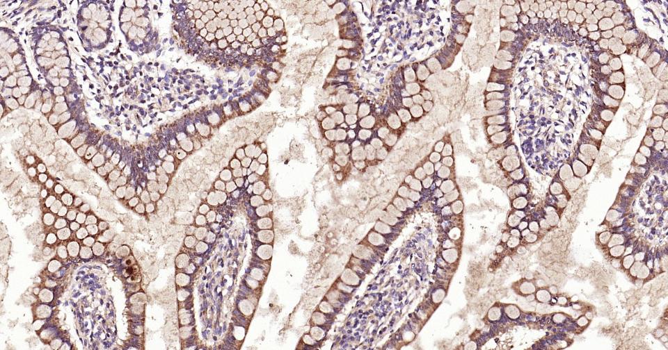 干细胞生长因子重组兔单抗
