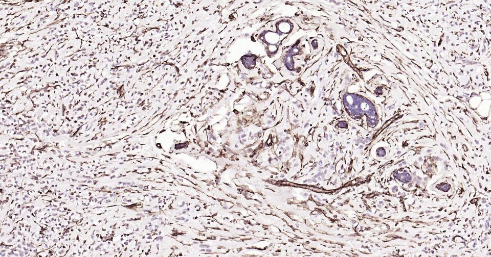 波形蛋白抗体-bs-8533R