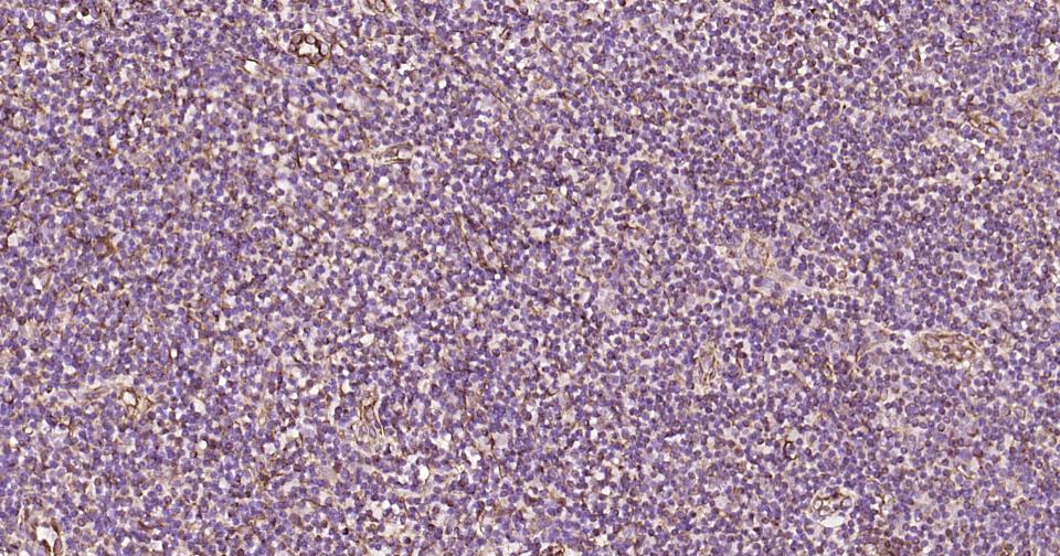 波形蛋白抗体-bs-0756R