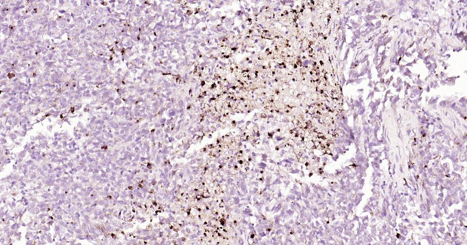 骨桥蛋白/分泌型磷蛋白1重组兔单抗