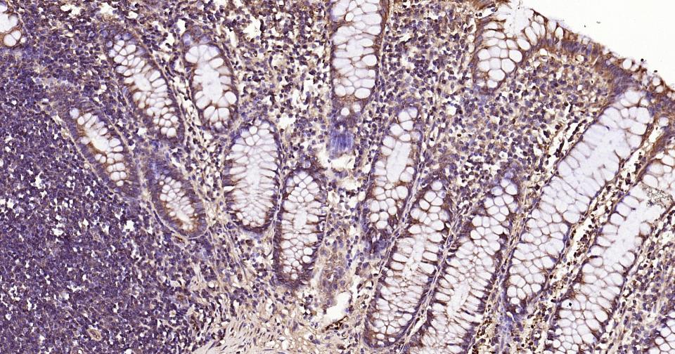 凋亡蛋白活性因子-1重组兔单抗