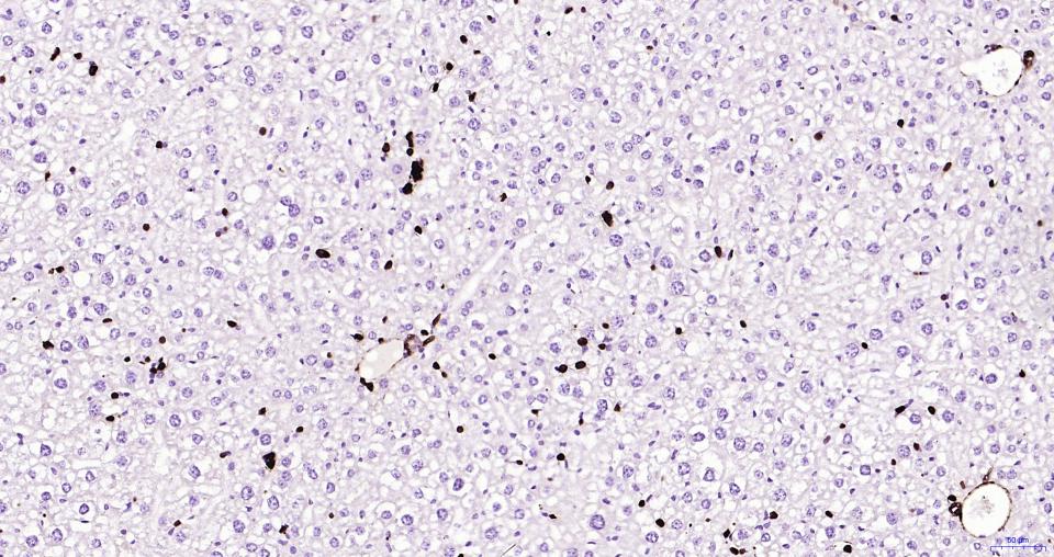 S100钙结合蛋白A6重组兔单抗