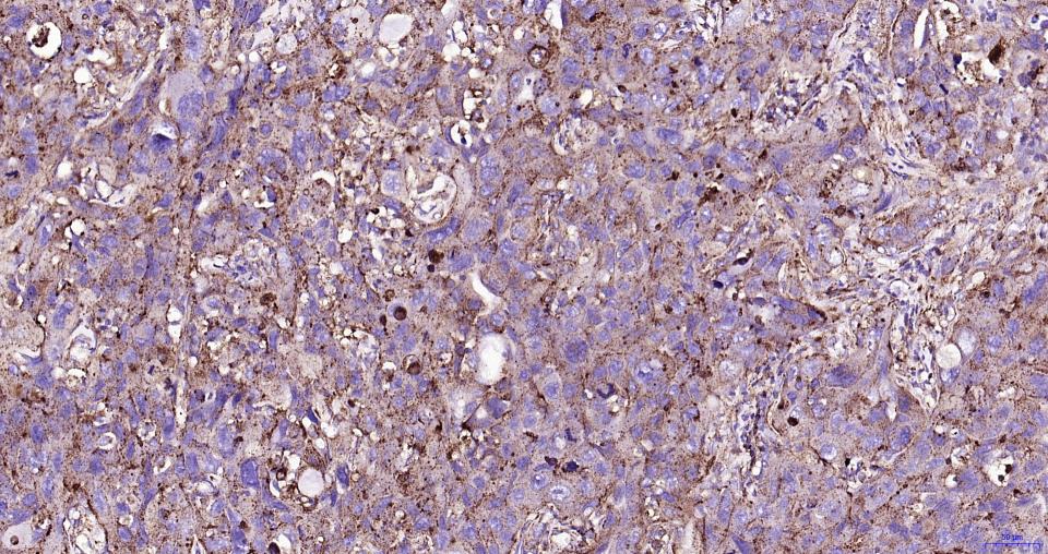 溶酶体相关膜蛋白1(CD107)重组兔单抗