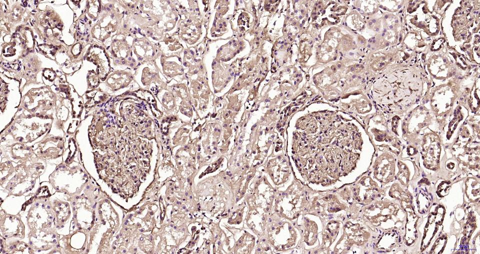 S100钙结合蛋白A6重组兔单抗