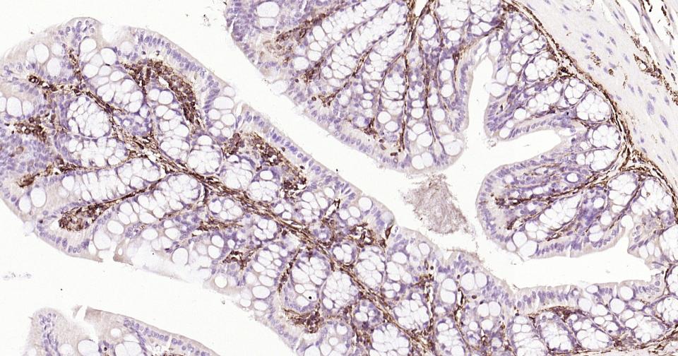 波形蛋白抗体-bs-8533R