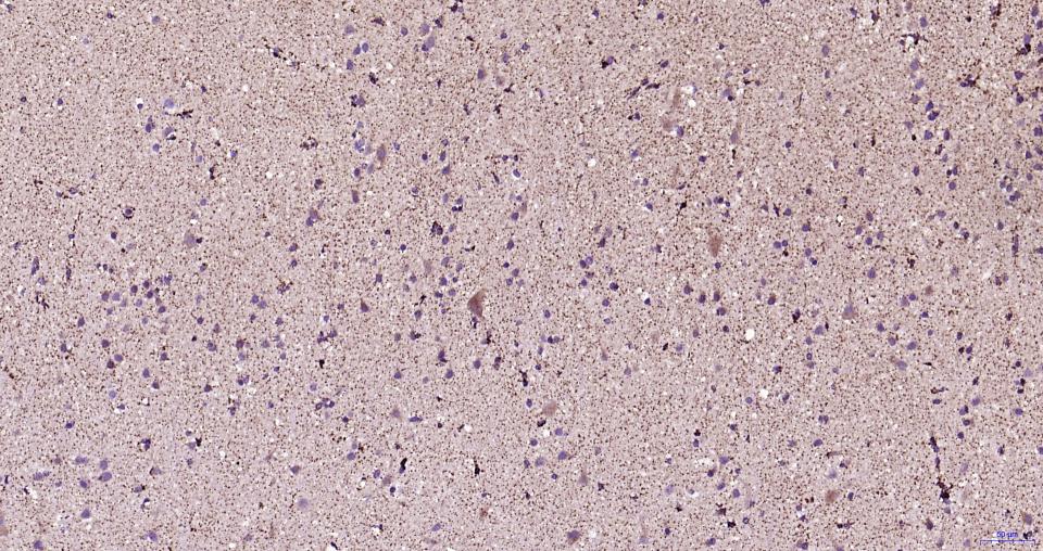 帕金蛋白重组兔单抗