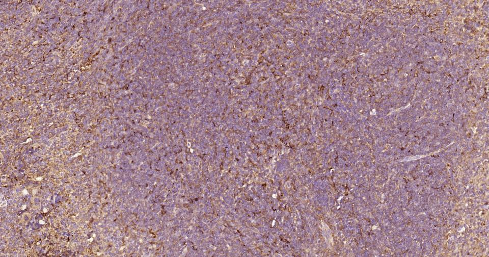 凋亡蛋白活性因子-1重组兔单抗