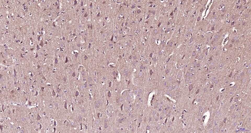 帕金蛋白重组兔单抗