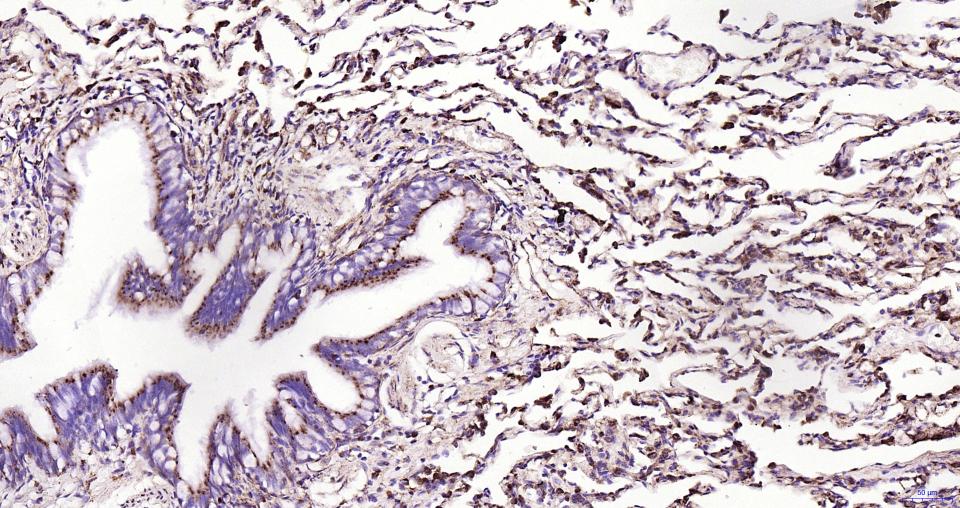 溶酶体相关膜蛋白1(CD107)重组兔单抗