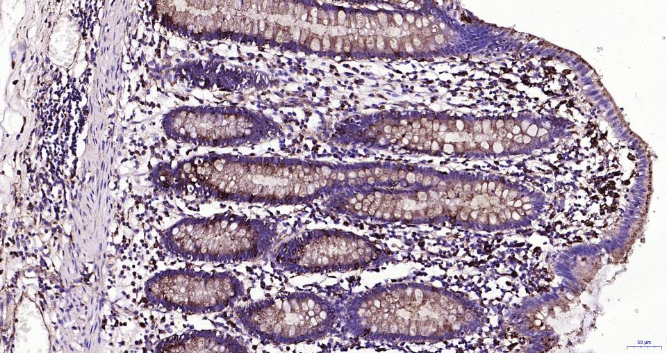 溶酶体相关膜蛋白1(CD107)重组兔单抗