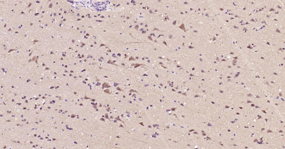 热休克蛋白90α重组兔单抗