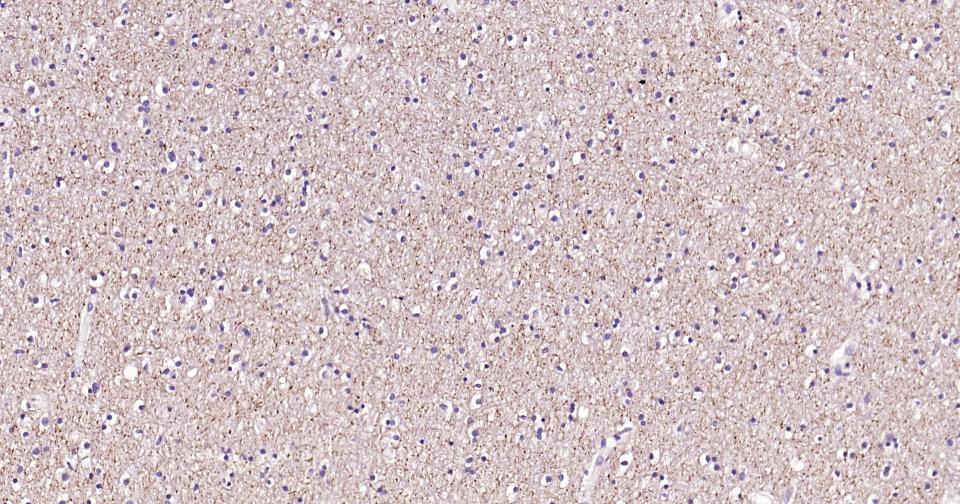 色氨酸羟化酶1重组兔单抗