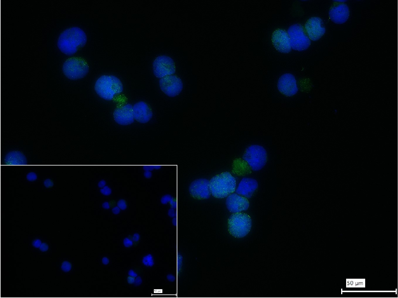 凋亡蛋白活性因子-1重组兔单抗
