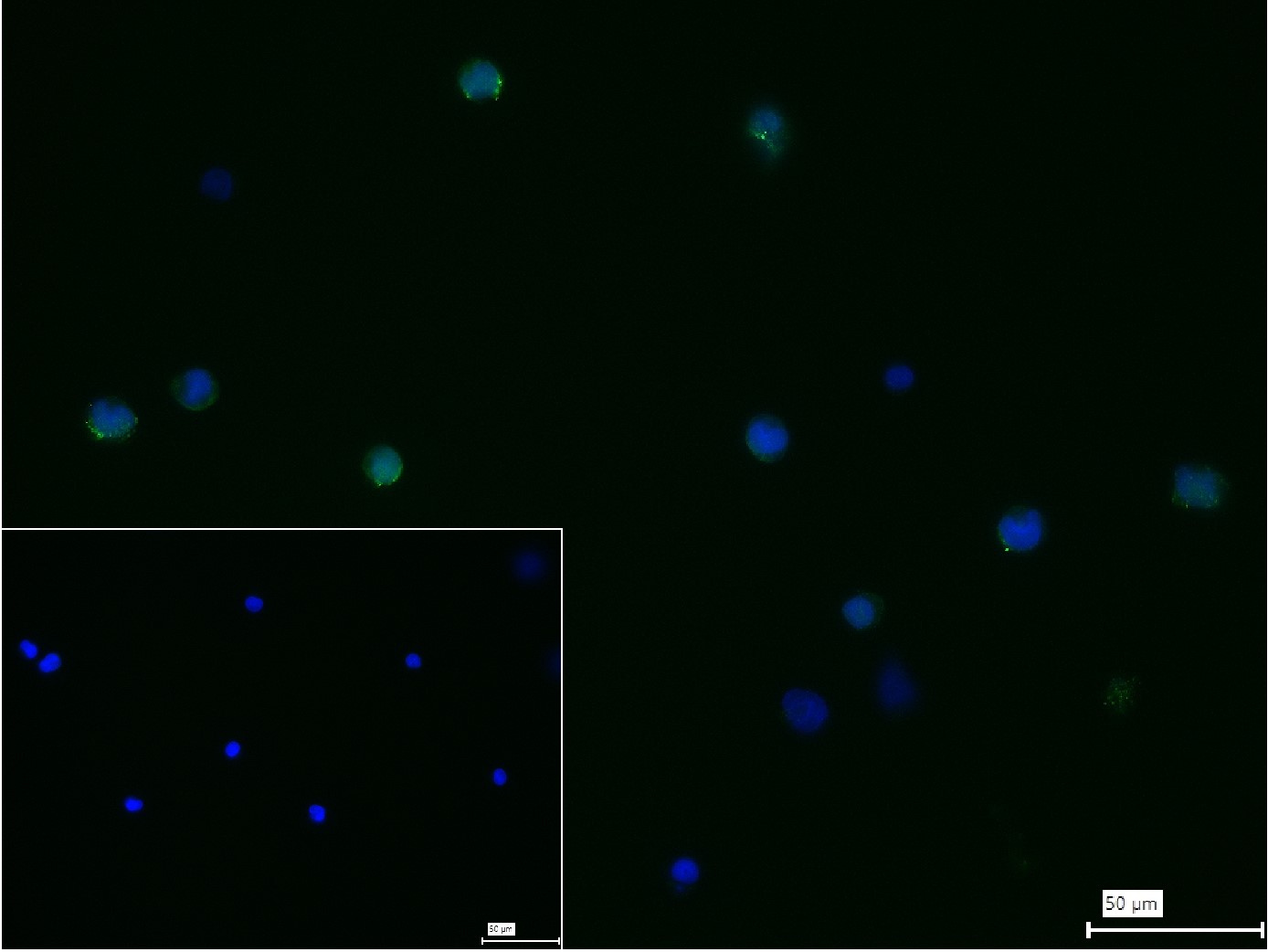 巨噬细胞甘露糖受体 (CD206) 重组兔单抗