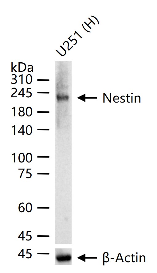 Nestin Mouse mAb (一抗) - WB,IHC-P,IHC-F,IF | Bioss