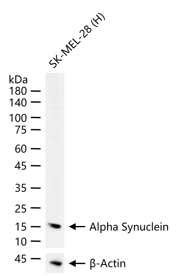 核突触蛋白-α重组兔单抗
