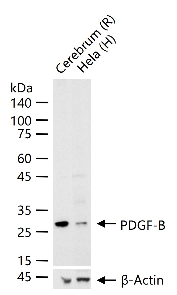 血小板源性生长因子-B重组兔单抗