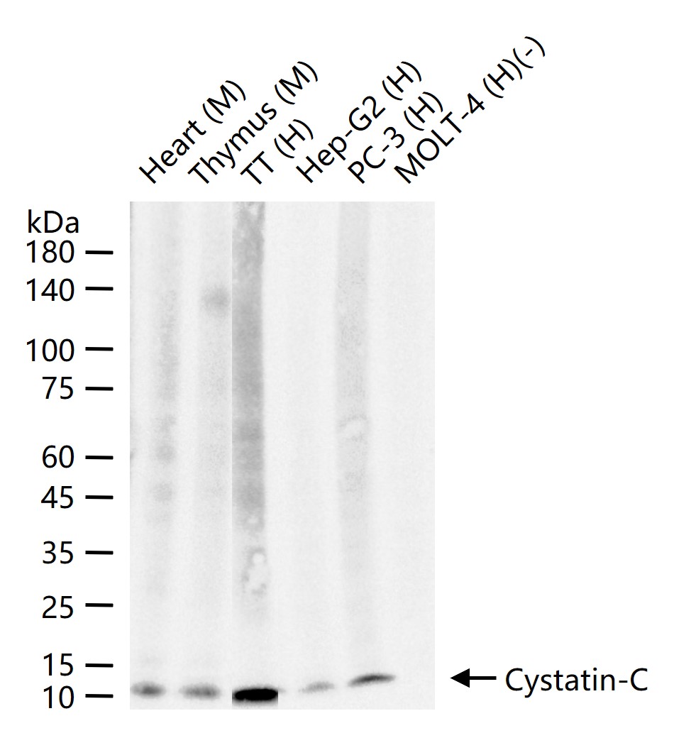 胱抑素C/半胱氨酸蛋白酶抑制剂C重组兔单抗