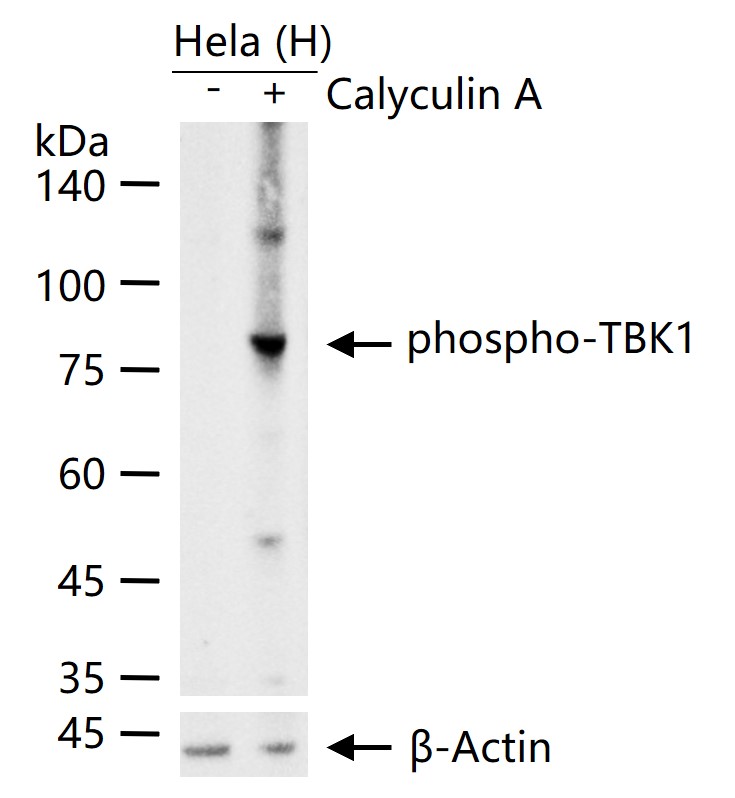 磷酸化NF-κB活化激酶重组兔单抗