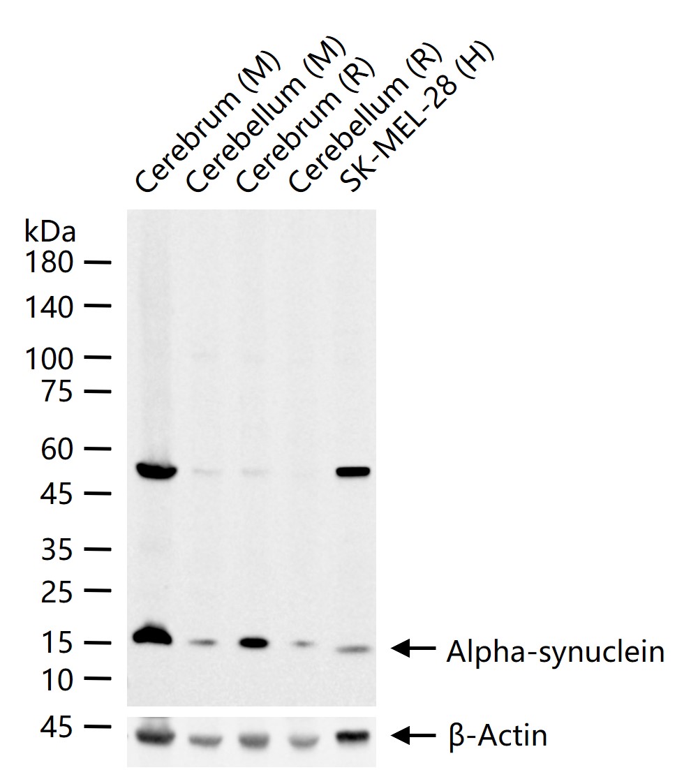 核突触蛋白重组兔单抗