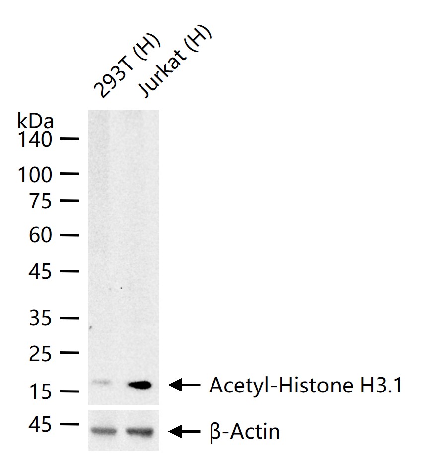 乙酰化组蛋白H3.1(Lys28)重组兔单抗