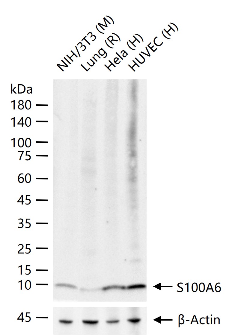 S100钙结合蛋白A6重组兔单抗