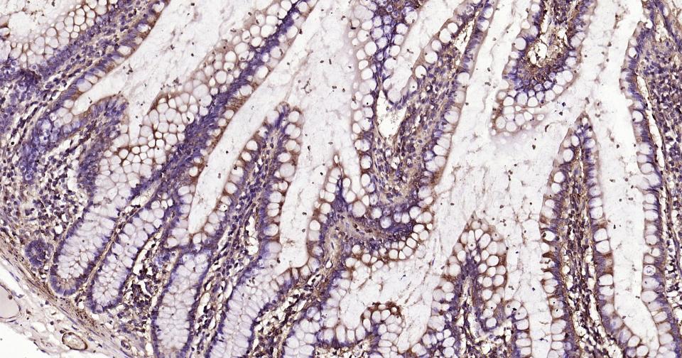 β-肌动蛋白/β-Actin（内参）单克隆抗体-bsm-33036M