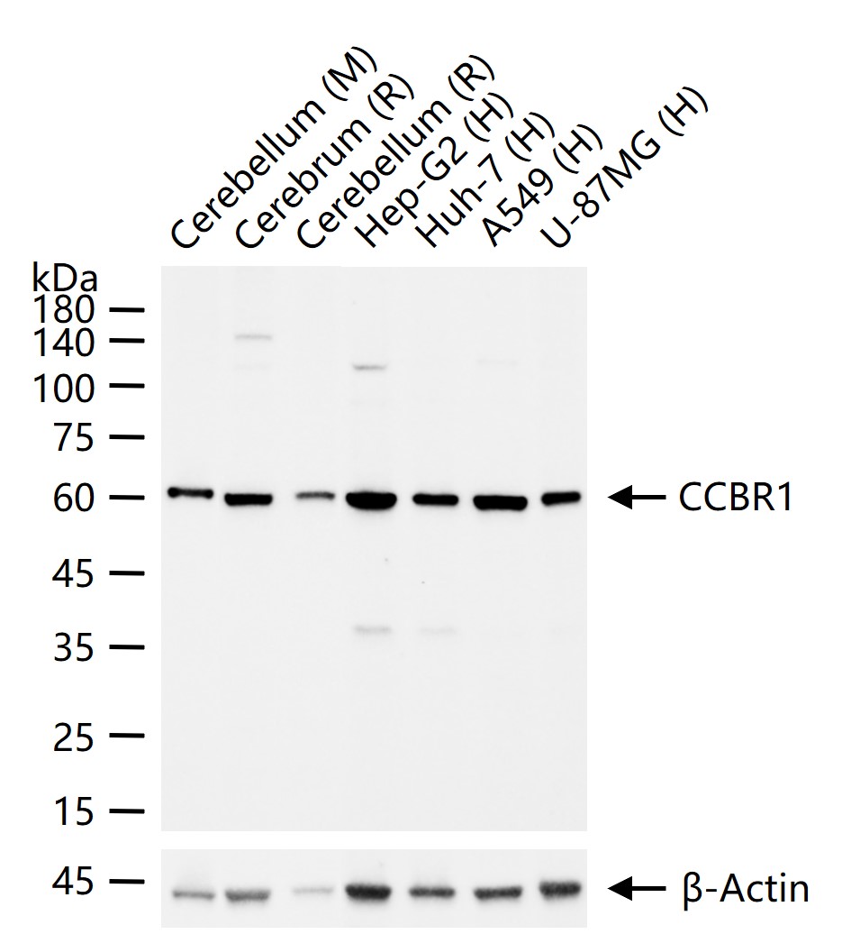 CCBR1 Recombinant Rabbit mAb (一抗) | Bioss