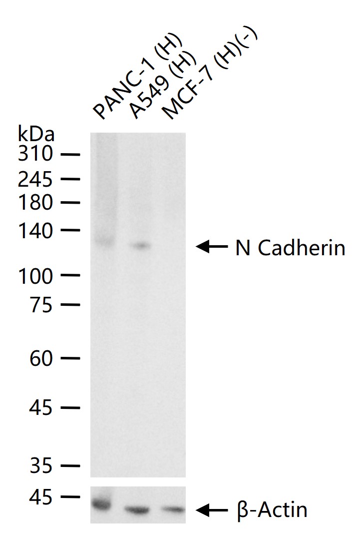 N-钙粘附分子重组兔单抗