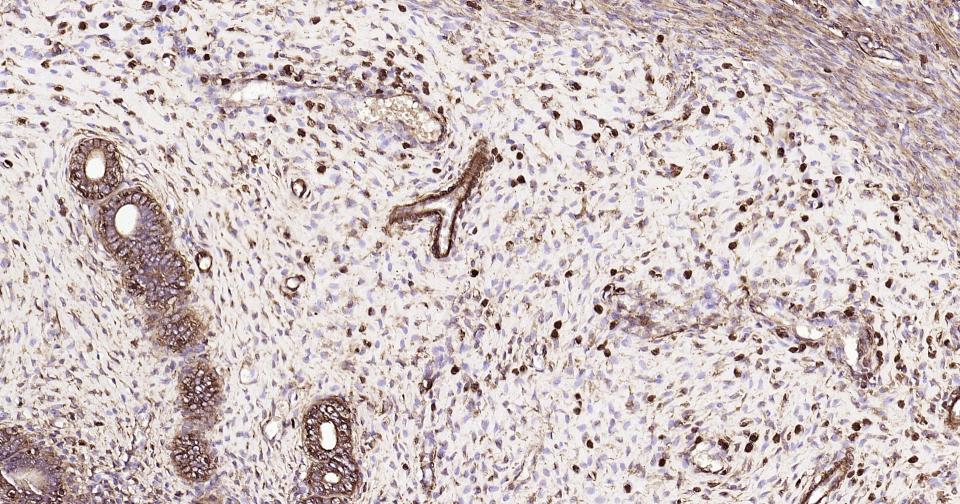 β-肌动蛋白/β-Actin（内参）单克隆抗体-bsm-33036M
