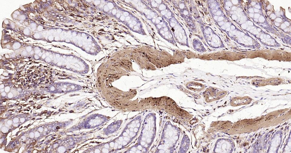 β-肌动蛋白/β-Actin（内参）单克隆抗体-bsm-33036M