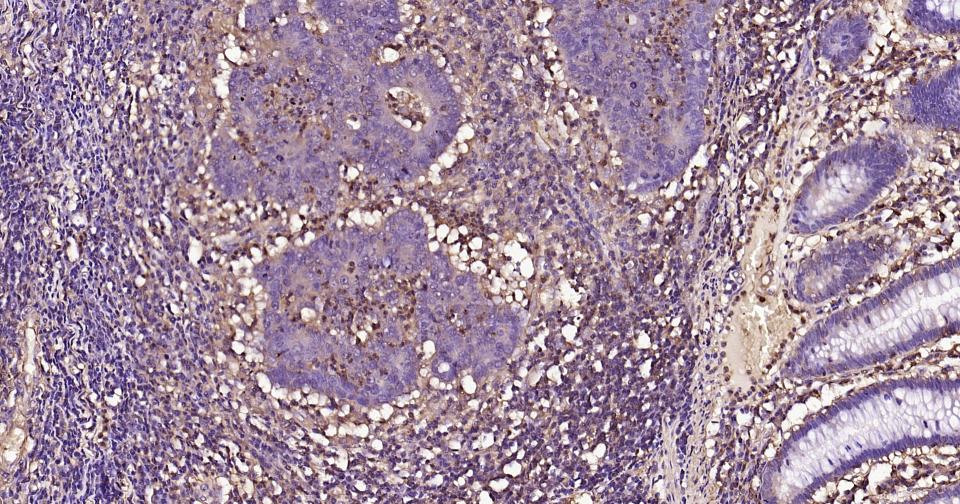 β-肌动蛋白/β-Actin（内参）单克隆抗体-bsm-33036M