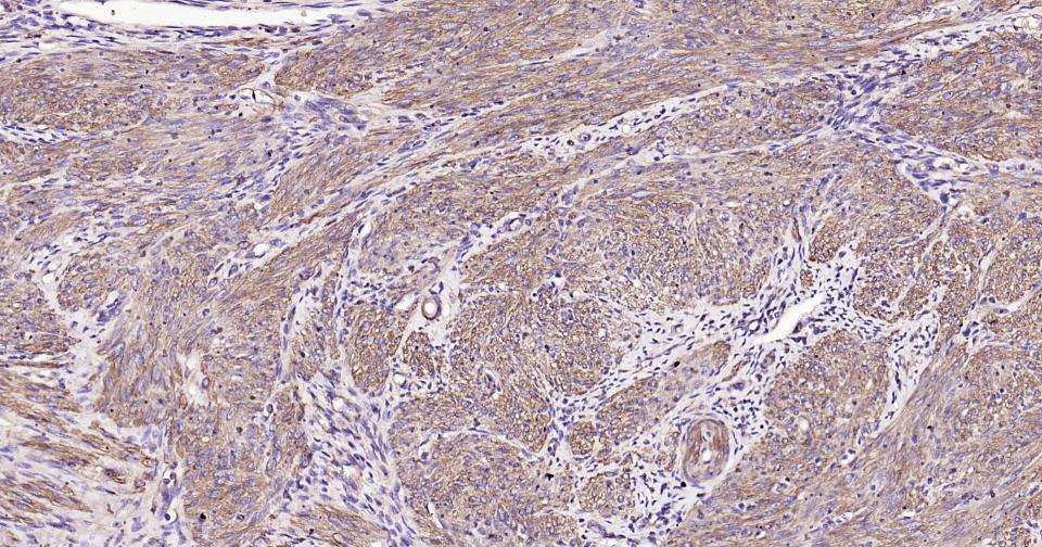 β-肌动蛋白/β-Actin（内参）单克隆抗体-bsm-33036M