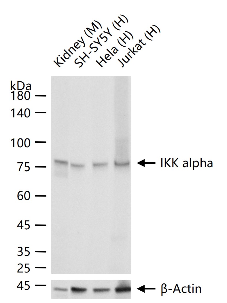 KB抑制蛋白激酶α重组兔单抗