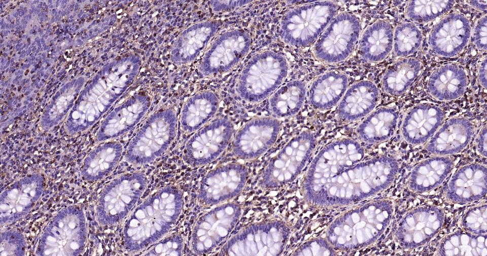 β-肌动蛋白/β-Actin（内参）单克隆抗体-bsm-33036M