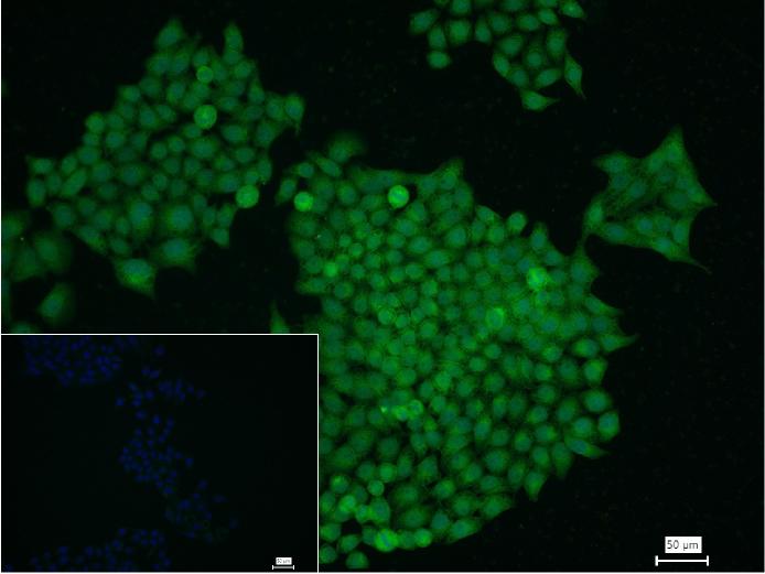 葡萄糖调节蛋白78重组兔单抗