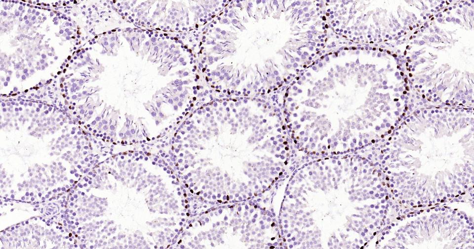 转录因子SOX9蛋白重组兔单抗