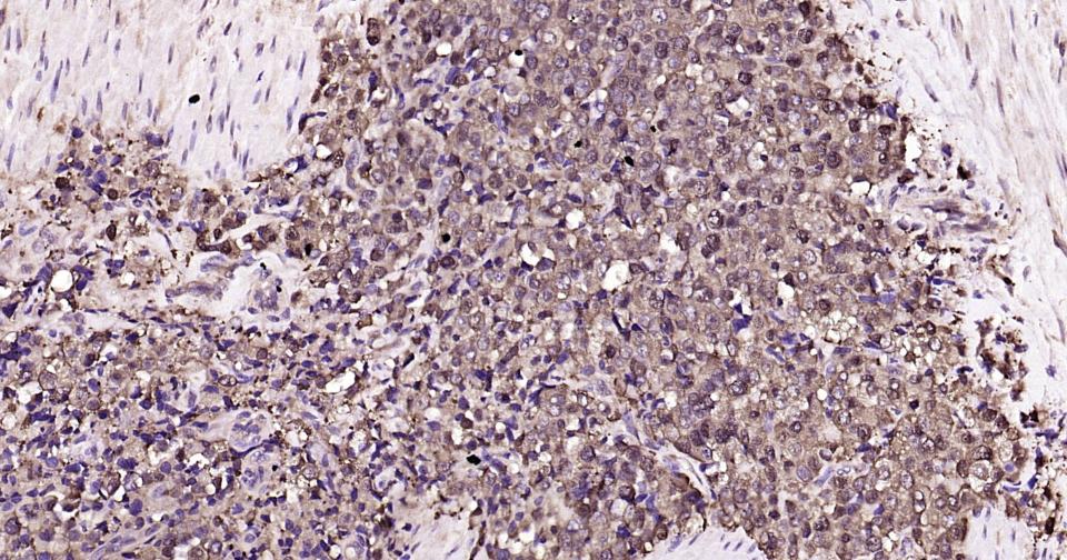 热休克蛋白90α重组兔单抗