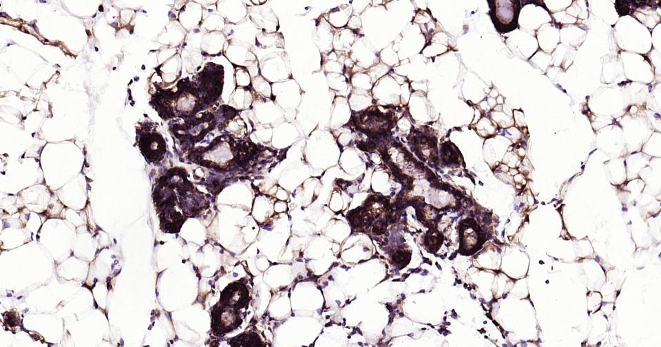热休克蛋白90α重组兔单抗