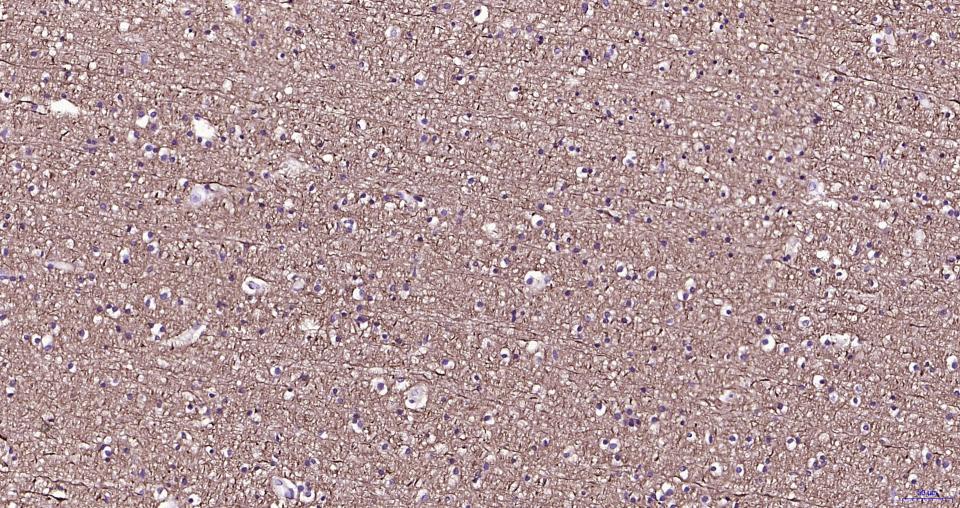 微管蛋白β tubulin/Tubulin β(内参)重组兔单抗