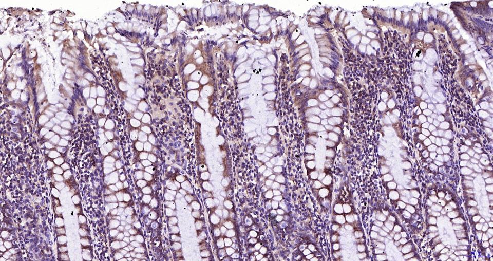 微管蛋白β tubulin/Tubulin β(内参)重组兔单抗