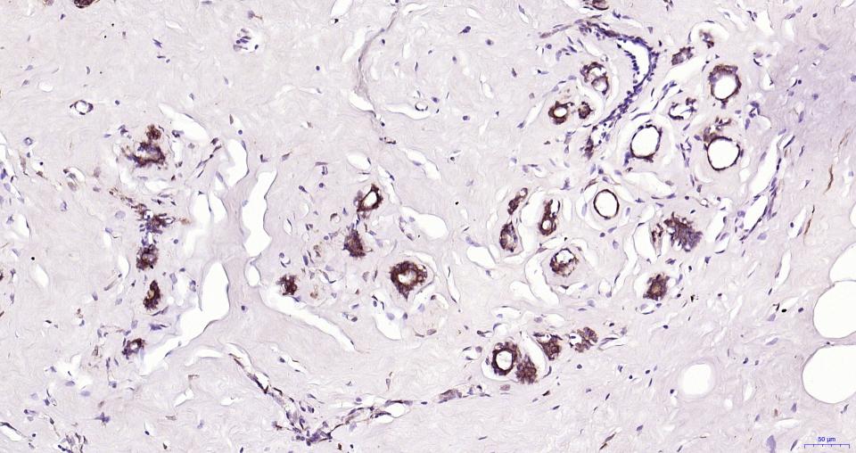 微管蛋白β tubulin/Tubulin β(内参)重组兔单抗