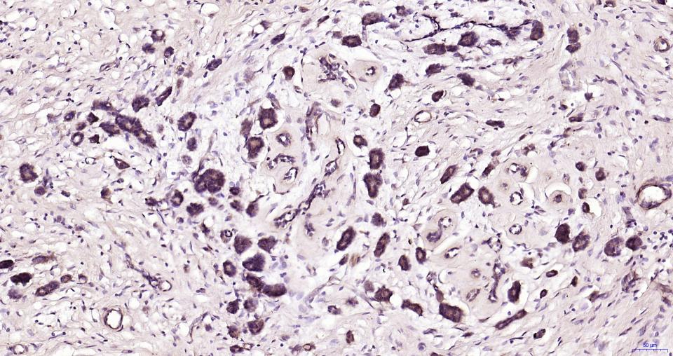 葡萄糖调节蛋白78重组兔单抗