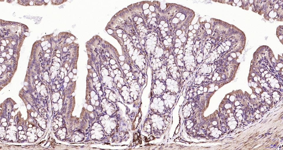 微管蛋白β tubulin/Tubulin β(内参)重组兔单抗