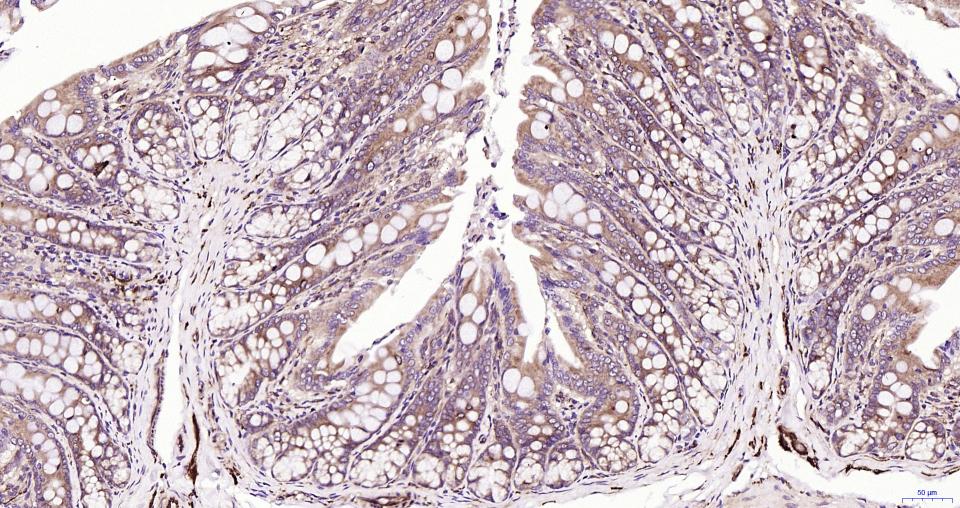微管蛋白β tubulin/Tubulin β(内参)重组兔单抗