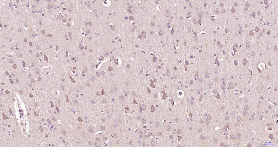 葡萄糖调节蛋白78重组兔单抗