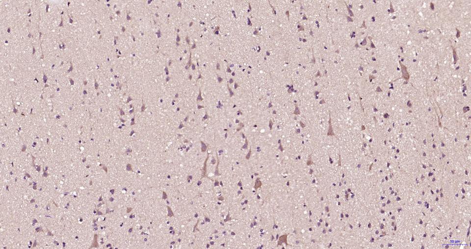 葡萄糖调节蛋白78重组兔单抗