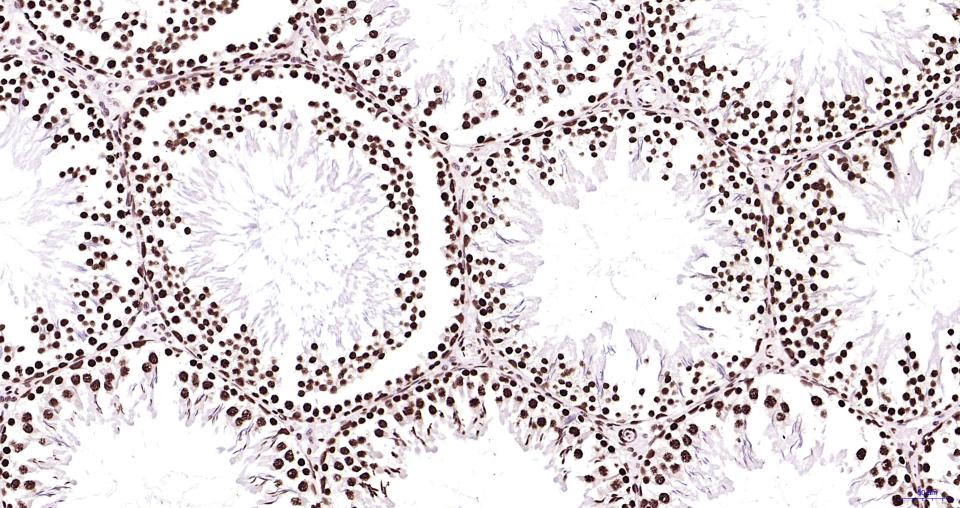 组蛋白H3(核内参)重组兔单抗
