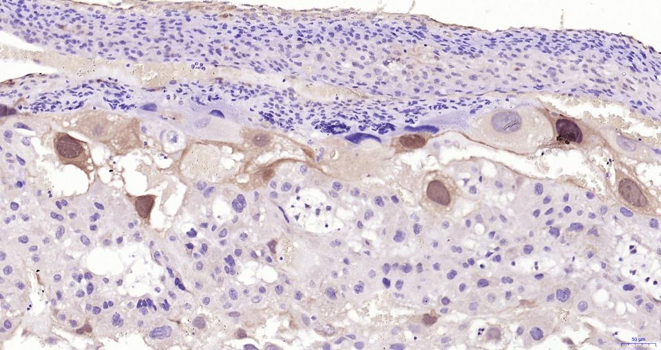 磷酸化丝裂原活化蛋白激酶1/2抗体